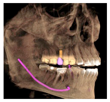 prevenzione-studio-dentistico-donadio-napoli-dentista-salerno-torre-annunziata-andi-campania-sprevestudio-dentistico-donadio-napoli-dentista-salerno-torre-annunziata-andi-campania-sbiancamento-radiologiabiancamento-radiologia